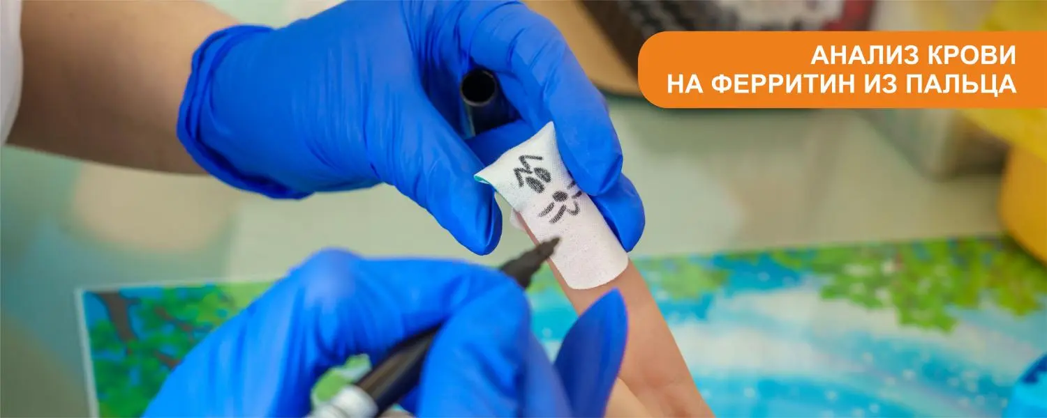 В нашей лаборатории можно сдать анализ НА ФЕРРИТИН из капиллярной крови (забор крови из пальца)