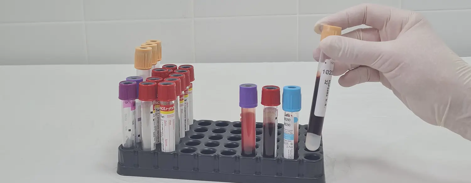 Гормональный фон