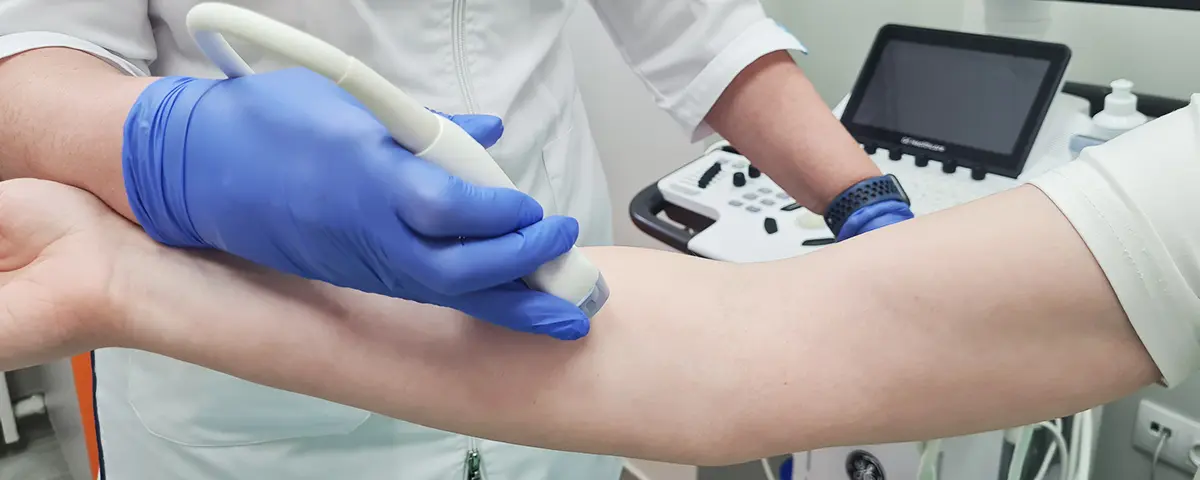 УЗИ периферических нервов