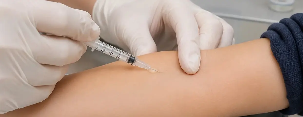 Туберкулиновая проба