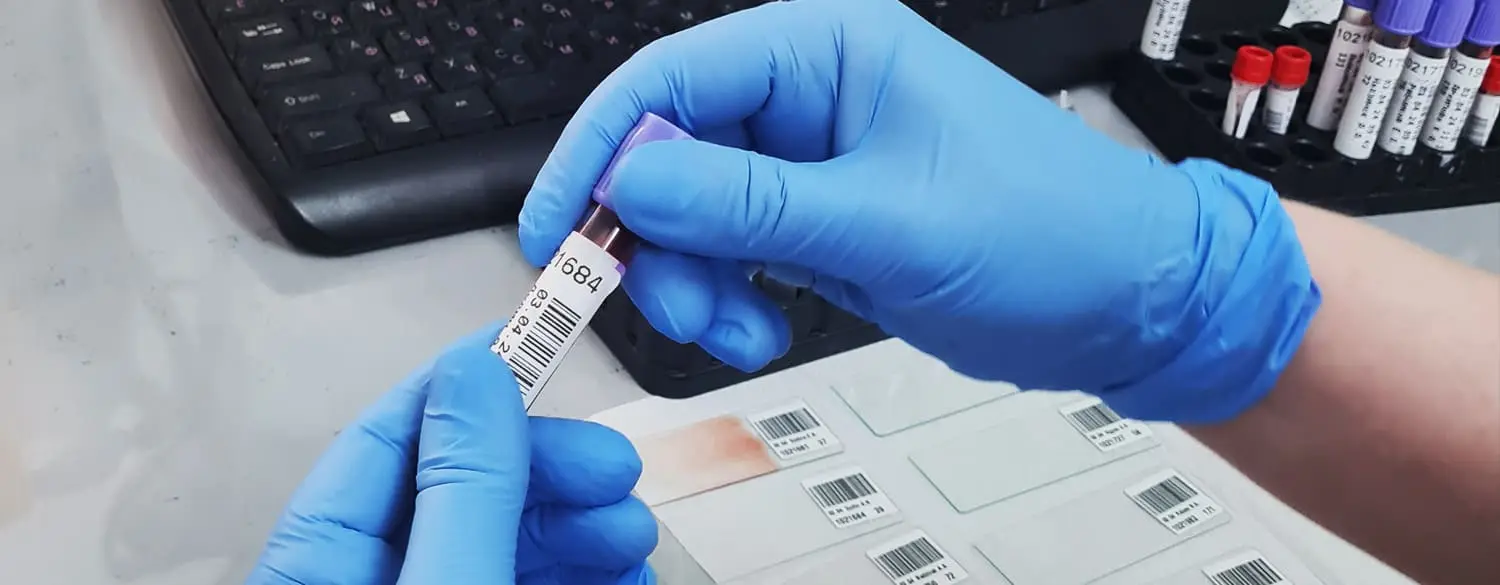 Подготовка к анализам