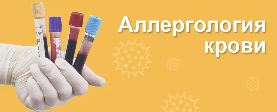Аллергологические исследования по крови